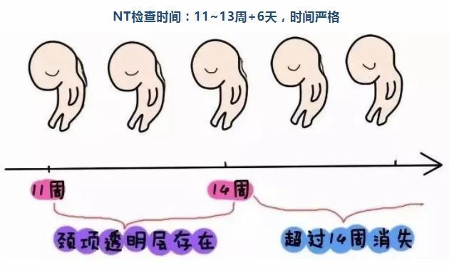 什么是NT检查、怀孕多少周做、结果异常咋办，10个问题带你了解NT