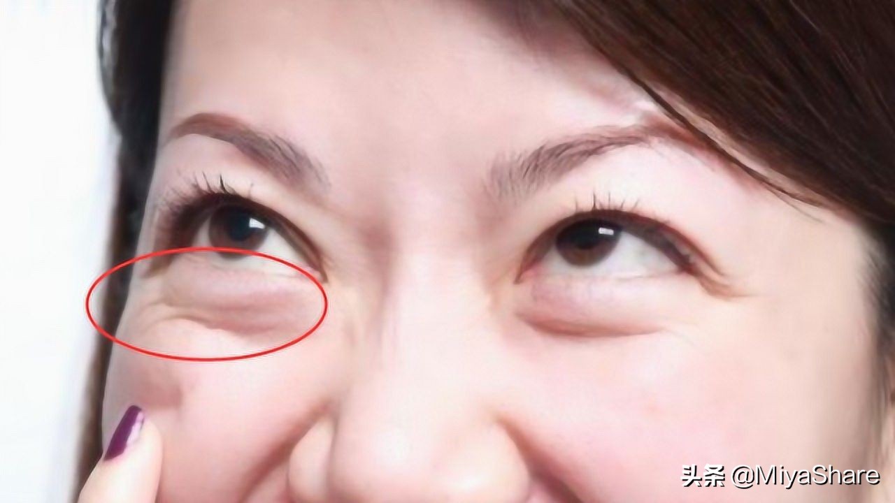 醒醒吧：什么眼霜都救不了黑眼圈！6款眼霜分析：这2款又贵又没用