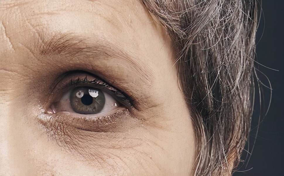 皮肤“不欢迎”4种食物，常吃或加重皱纹，希望没有你爱吃的