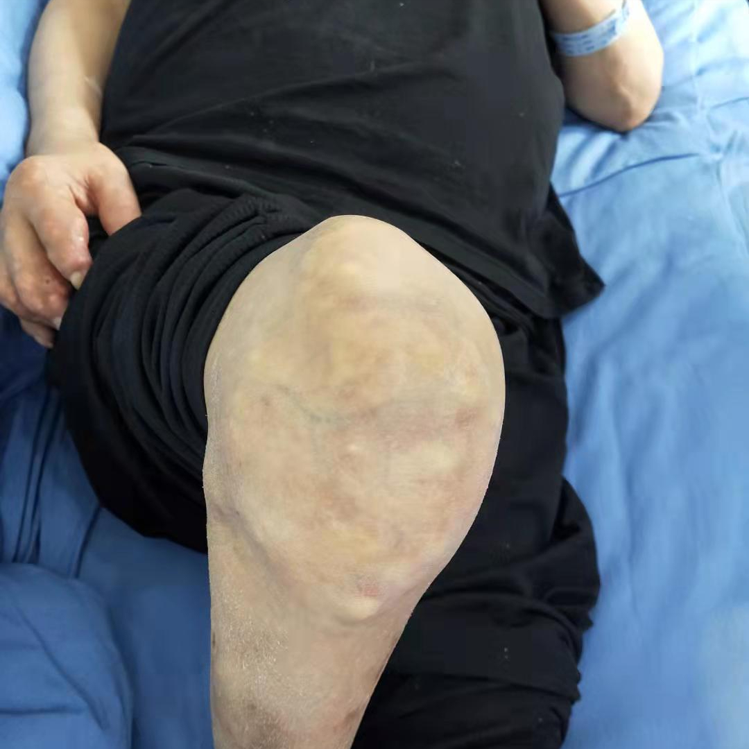 老年人为什么容易膝盖疼？要小心6种疾病，个个危害巨大