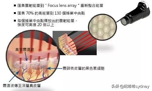 亲身体验｜蜂巢皮秒到底有用吗？