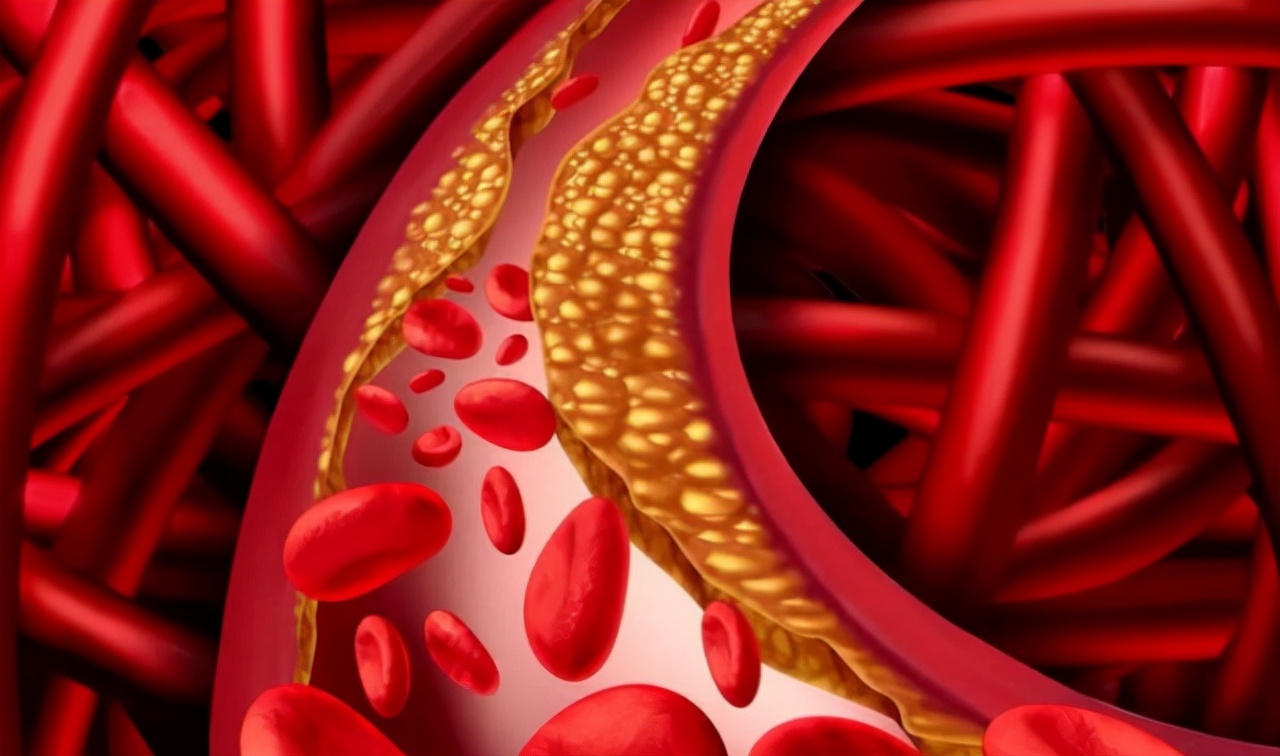 生花生和熟花生，哪个更营养？提醒：5类人最好少碰，别不当回事