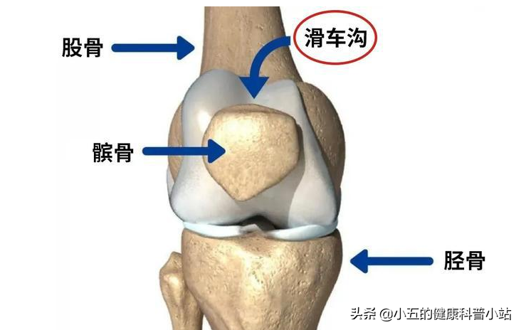 膝关节咔咔作响，上下楼疼痛不适，髌骨软化症到底该如何治疗