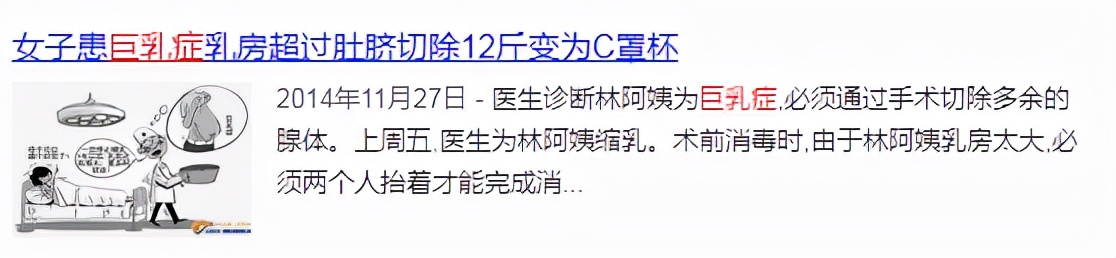 乳房巨大(被“巨乳症”折磨的女生，有苦说不出：就像胸前挂着11瓶矿泉水)