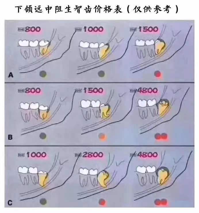 患者说为什么他拔智齿我要收1300，而他的朋友只要400元？