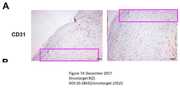 徐州医科大学附属医院发表的SCI论文因图片疑似重复被质疑