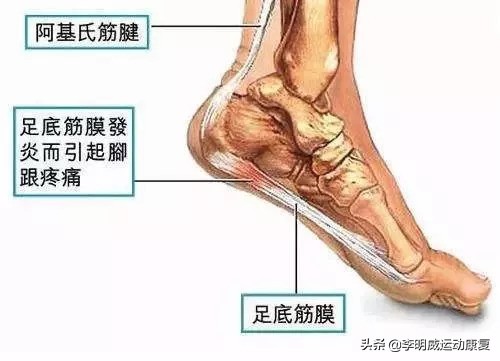 经常脚疼？可能和你脚底的一根筋有关