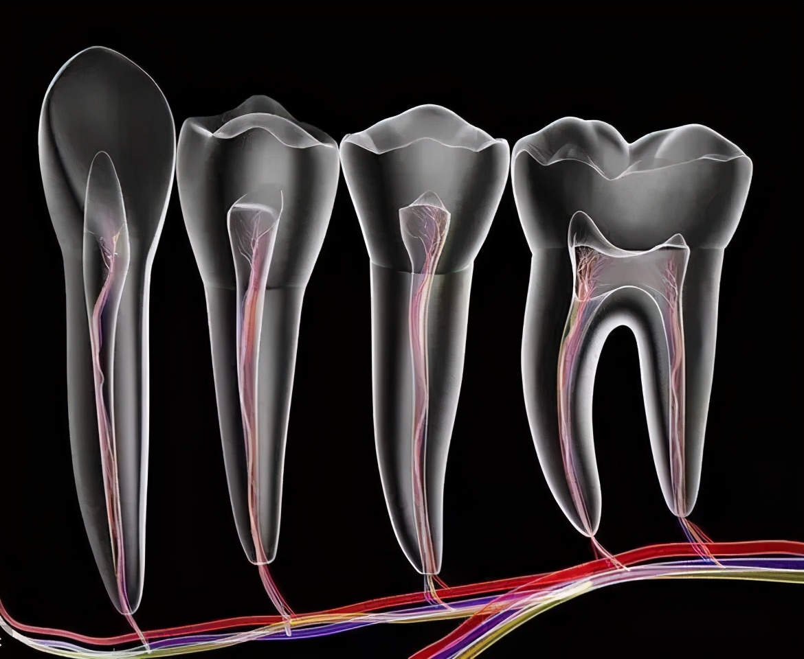 根管治疗是不是就是“杀神经”？