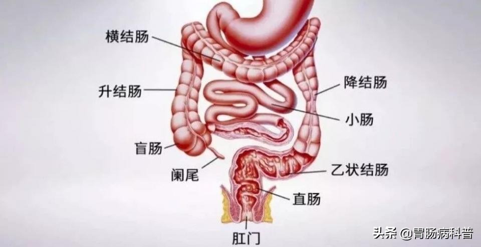 想做一次肠镜：普通的太疼，麻醉的太贵，有没有不用麻醉还无痛的