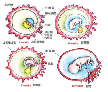 宝宝便血≈食物过敏？停母乳？别犯傻！小心“美克尔憩室”在作祟