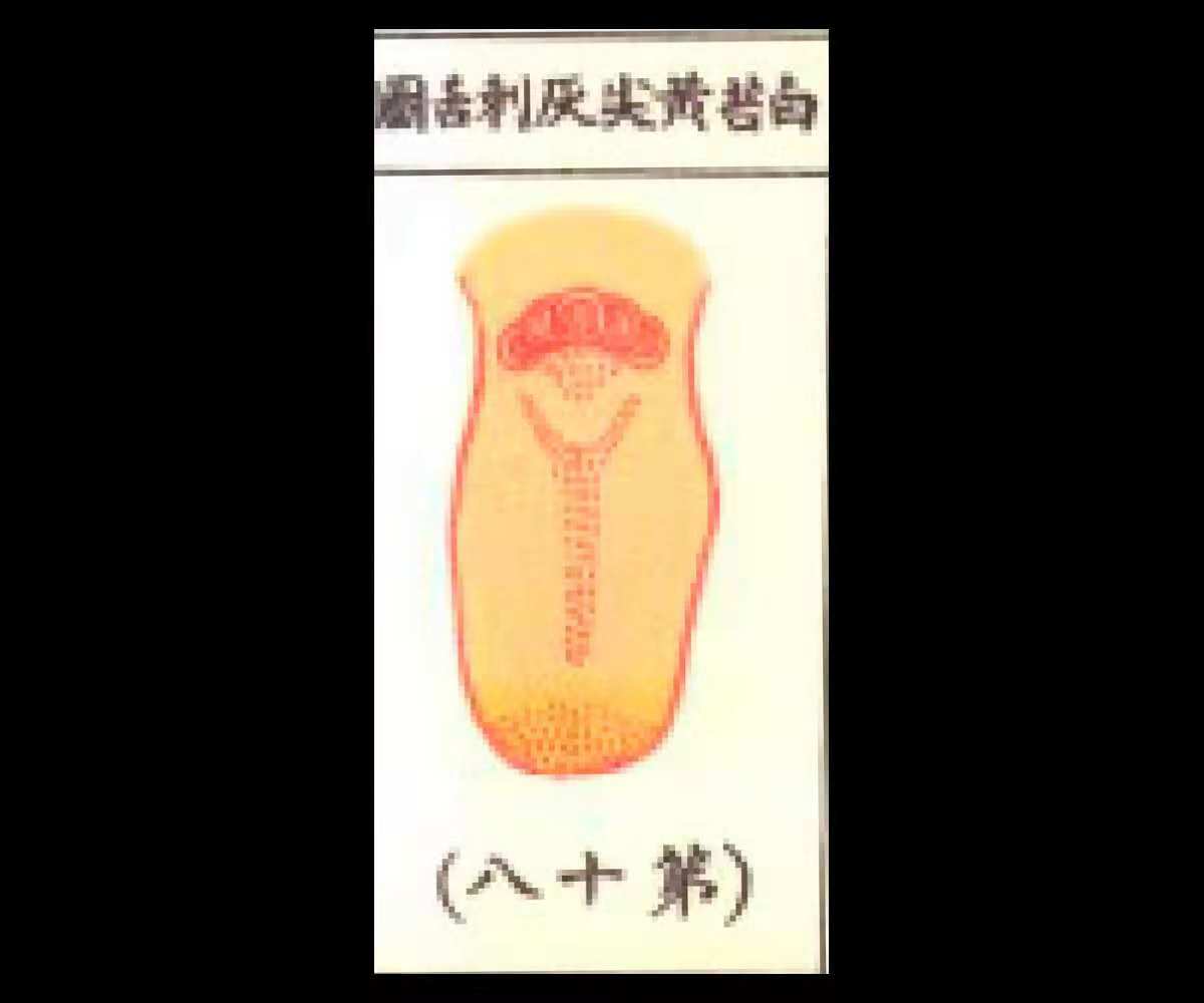 白苔黑刺舌，则热郁阳明腑；白苔黑刺舌，则夹食伤寒、胃冷膈热