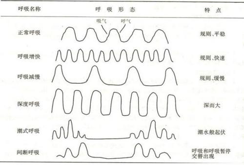 这样判断孩子是不是肺炎很方便，出现这些症状需要马上就医