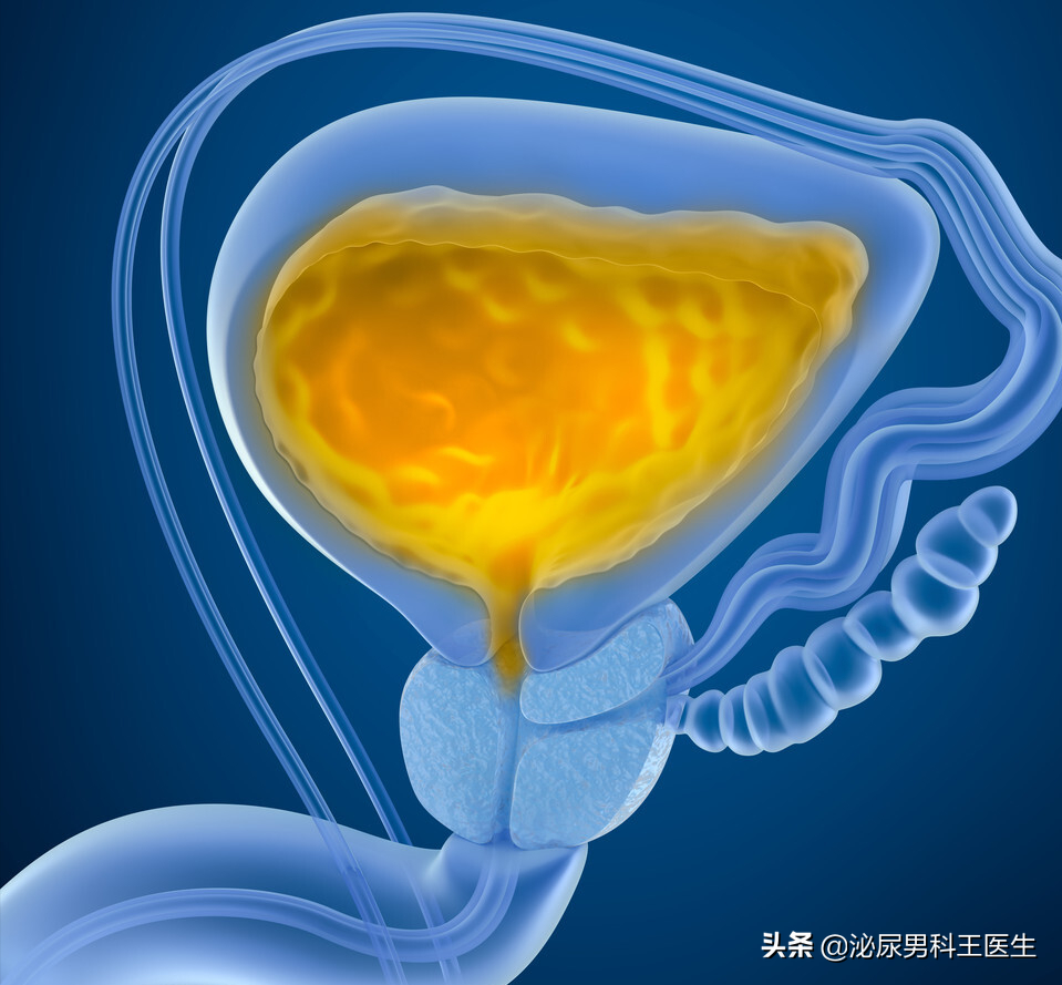 前列腺增生详解！是怎么引发的？有什么表现？如何预防和治疗？