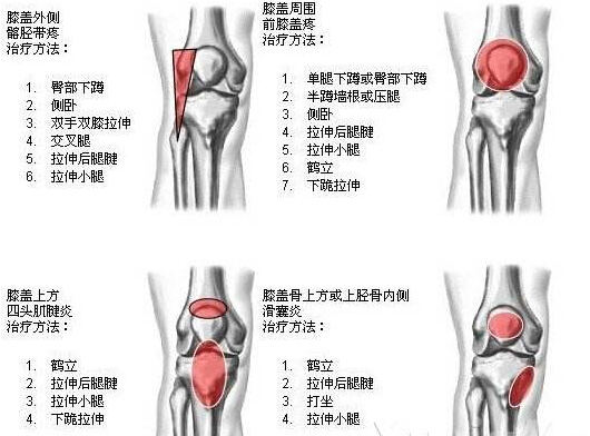 深蹲膝盖咔咔作响怎么办？2个动作解决你的弹响问题