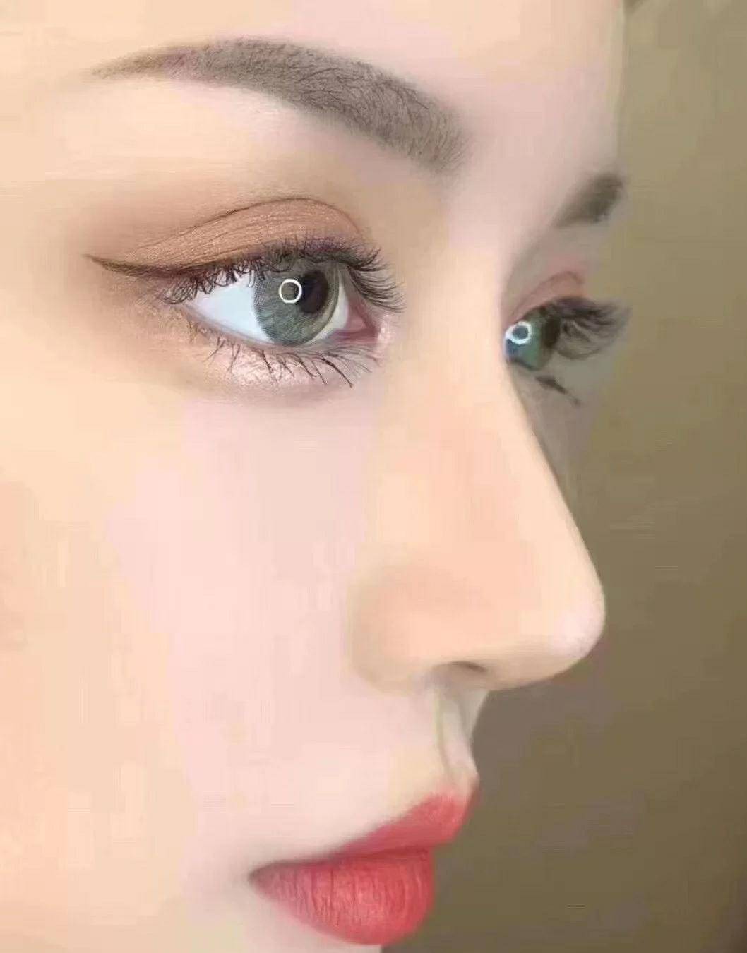 狮子鼻图片(鼻型多种多样) - 赤虎壹号