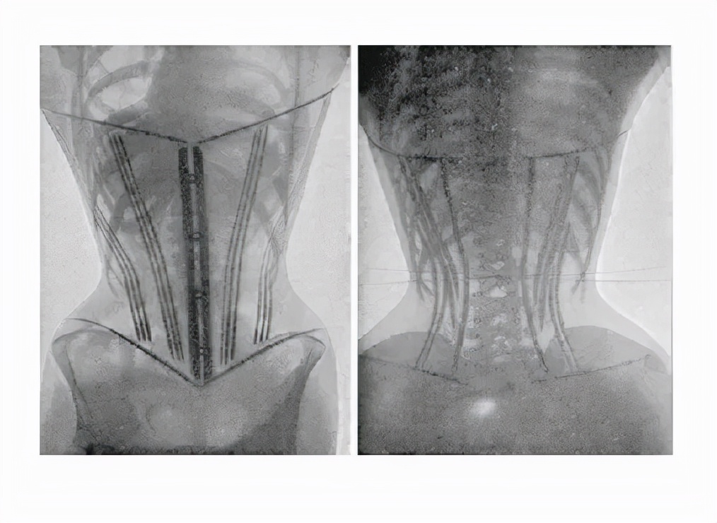 产后漏尿、大肚腩，该如何修复？在家可以这样做
