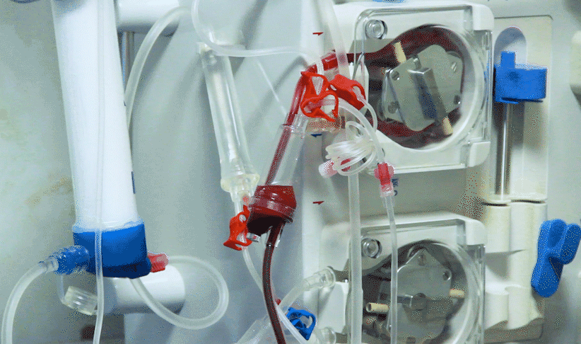 尿酸500多，一吃药降、一停药升，痛风和药物伤肝肾，你选择谁？