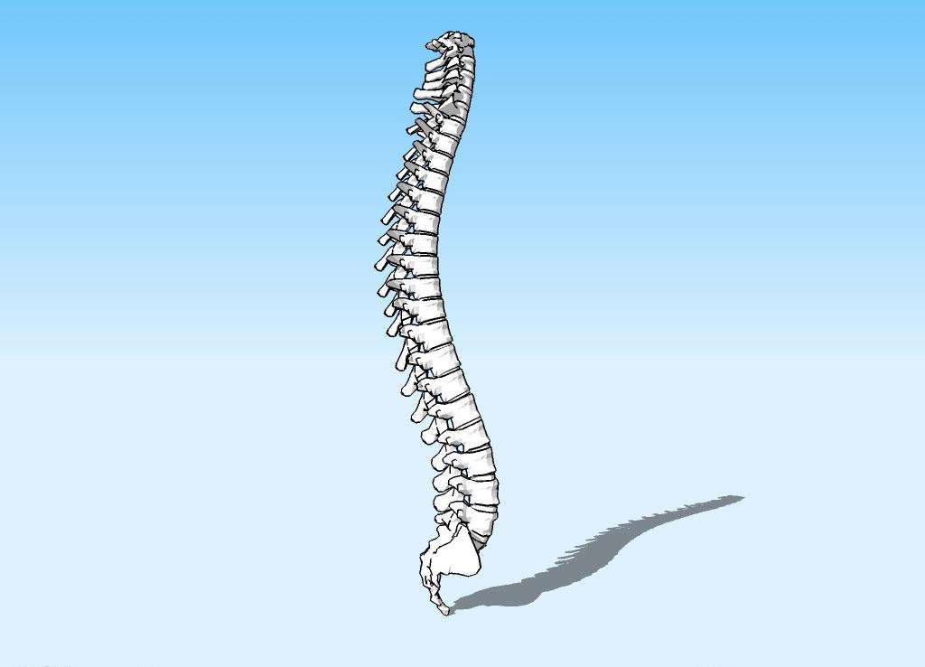 先天性脊柱側彎，患病原因不僅複雜，且臨床表現較嚴重，及時診治
