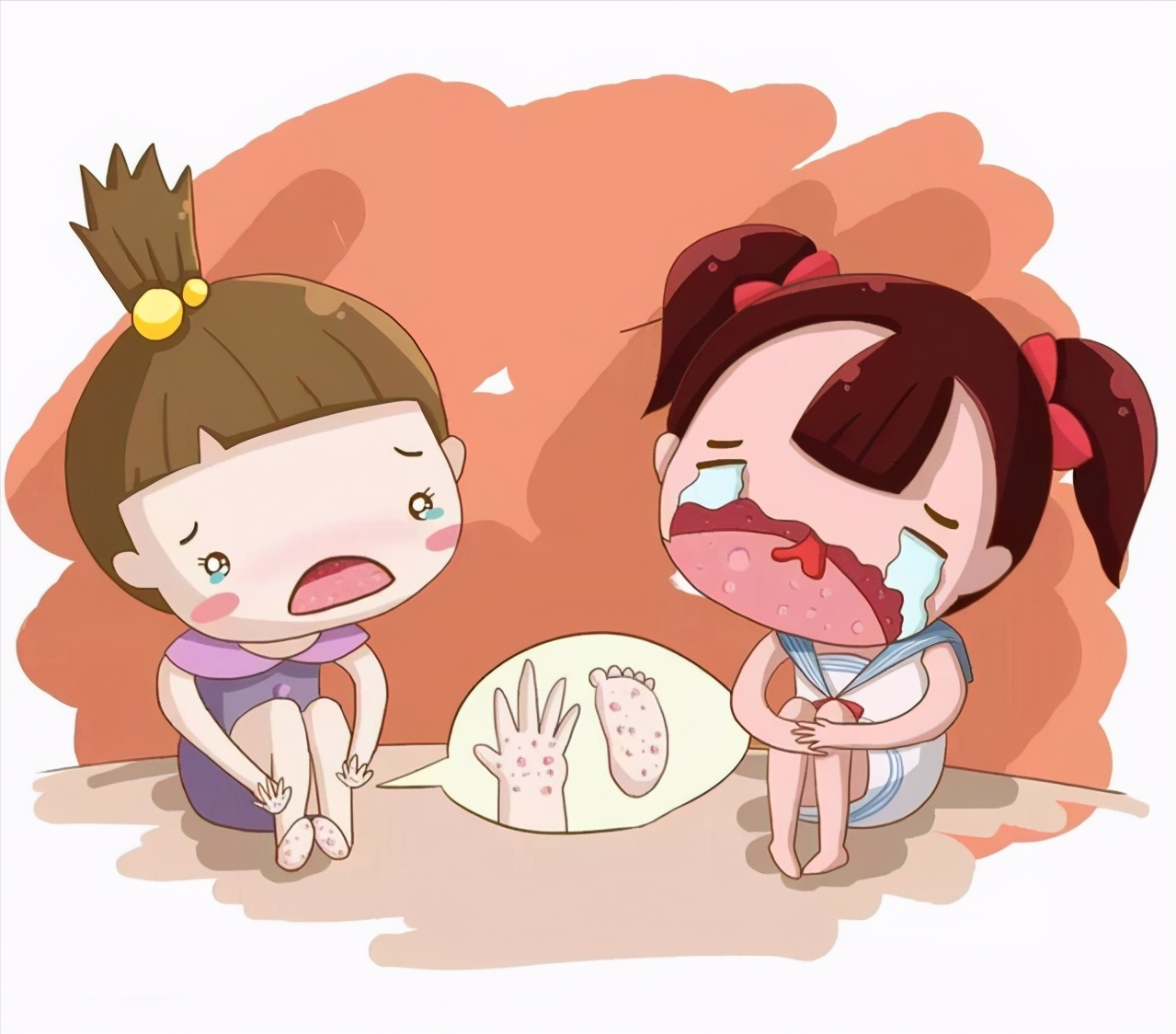 口周炎的症状和图片(今年疱疹性咽峡炎为什么比往年来得更早一些)