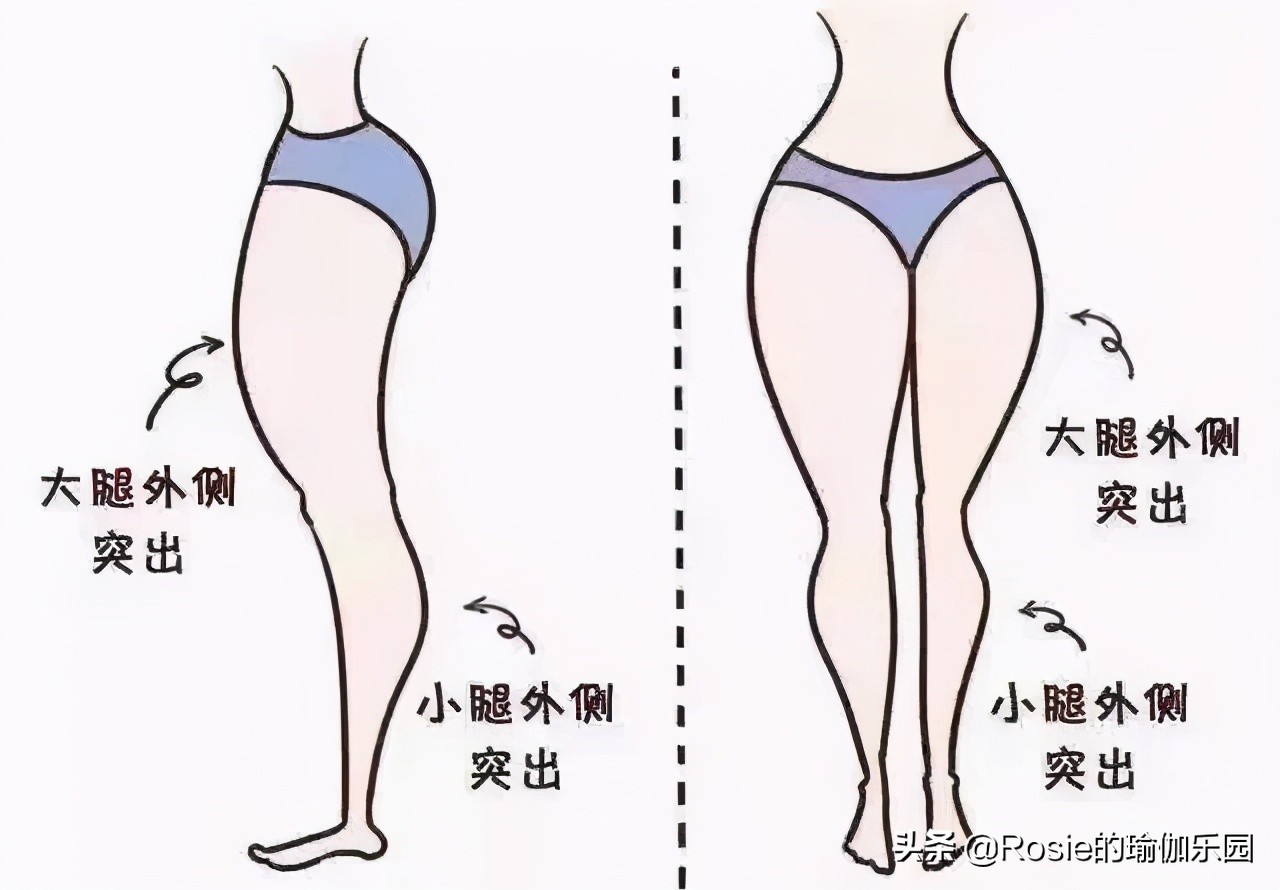 假胯宽、臀肥腿壮？要瘦腿先分清粗腿成因，不走弯路美腿这样瘦