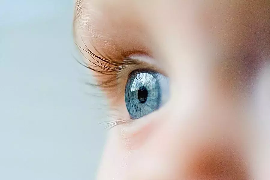 对眼、红眼病、弱视、倒睫……宝宝常见的眼部问题,一篇搞定