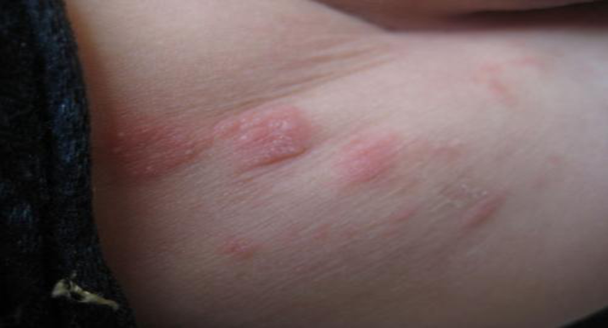 爽身粉是个错误选项,新手宝妈千万别犯傻