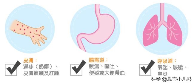 婴儿对牛奶过敏喝什么奶粉（牛奶蛋白过敏宝宝水解奶粉吃多久）