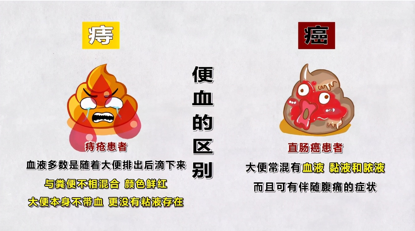 痔疮最会"画皮"成直肠癌!快速区分就看这2点