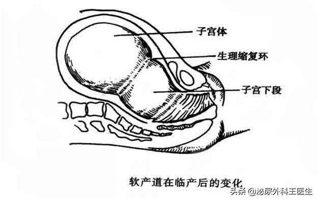 女人切除子宮，对性生活有什么影响呢？