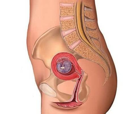 春节后怀疑自己怀孕了怎么办？三招判断：看表现、用工具、做检查