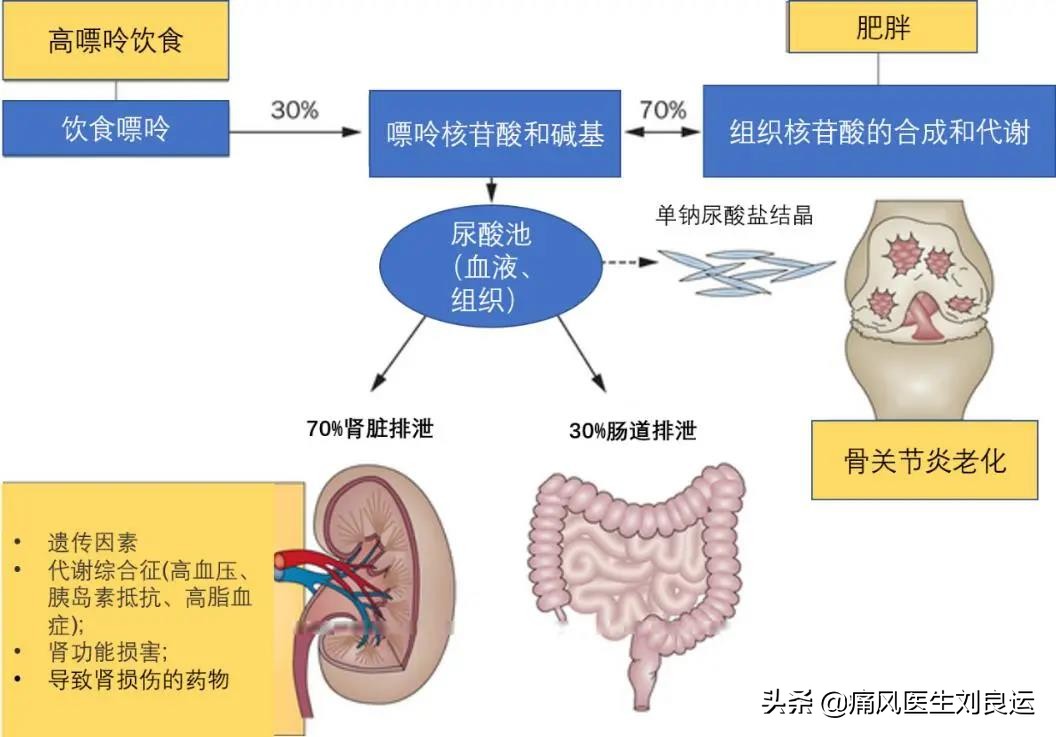 痛风患者降尿酸选哪种药？七种方法分辨尿酸生成过多还是排泄减少