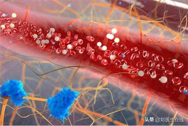 低密度胆固醇偏高怎么回事？详解低密度脂蛋白超标原因