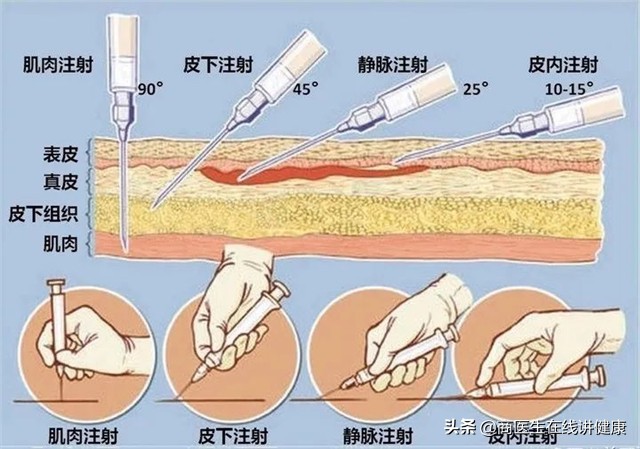 甲钴胺片是营养神经的"扛把子"，吃多久能停药？医生正面回答了