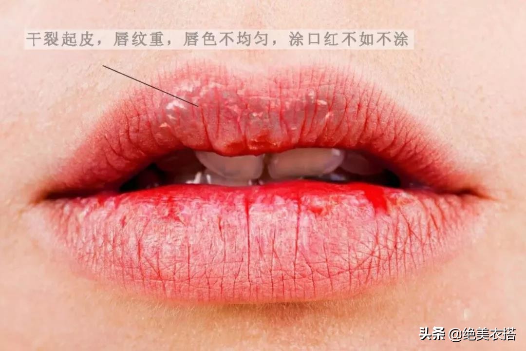 嘴唇干裂、唇纹明显？影响你颜值的小细节正在毁了你，这一招可解
