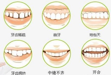 儿童矫牙大概要多少钱？你想知道的都在这里了