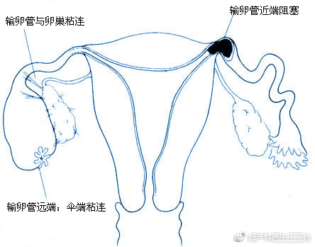 一次人工流产，对人体的伤害到底有多大？妇科医生说了大实话