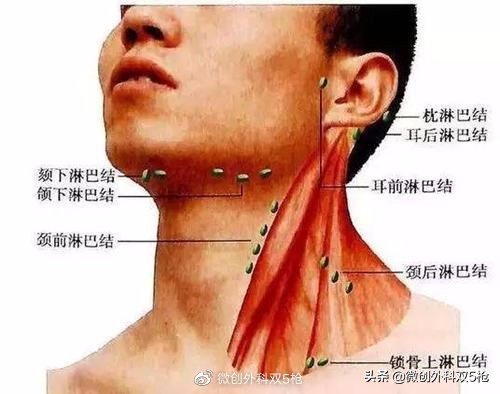 颈部淋巴结肿大，正常现象还是癌症转移？