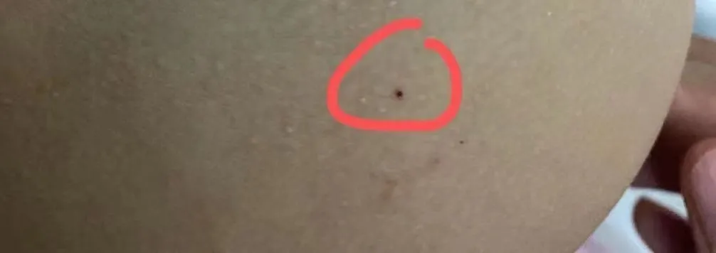 红黄蓝“换马甲”又虐童?每月学费1万2,老师针扎孩子被家长报警
