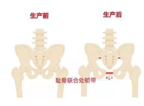 束腰、乳腺贴、卵巢保养，细扒那些瞄准你钱包的“营销骗局”