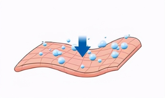 油痘肌，黑头，闭口几乎占全有合适的护肤品推荐吗？