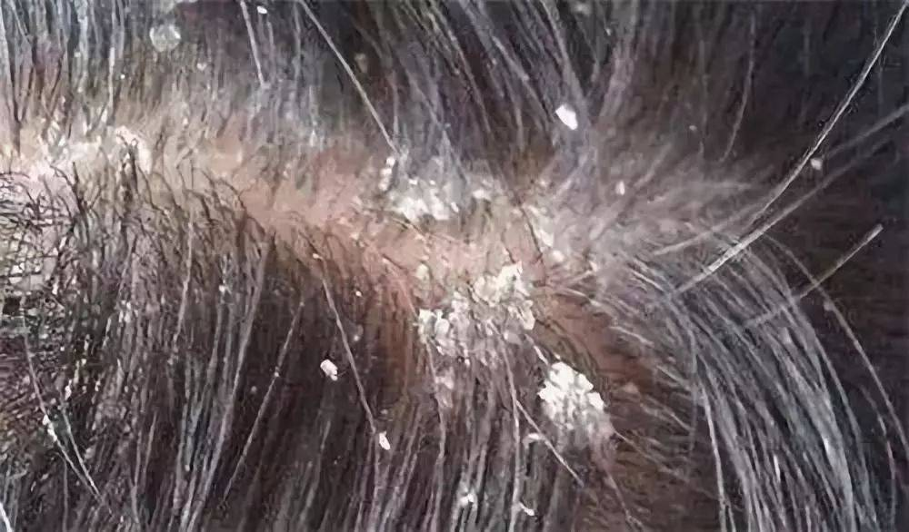 洗发水的种类和选择，你都知道吗？