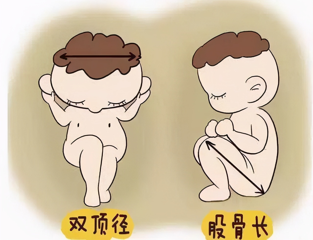 双顶径看男女:头小腿长是女孩,头大腿短是男孩?