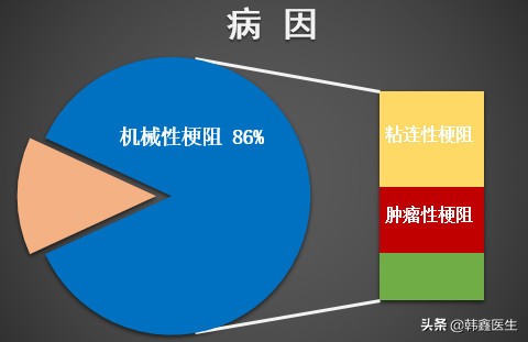 肠梗阻的诊断和治疗