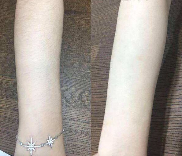 涂身体乳vs不涂身体乳，不仅皮肤差距大，原来“毛发”也跟着长