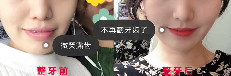 深度解答：整牙的过程是怎样的？干货满满，建议收藏