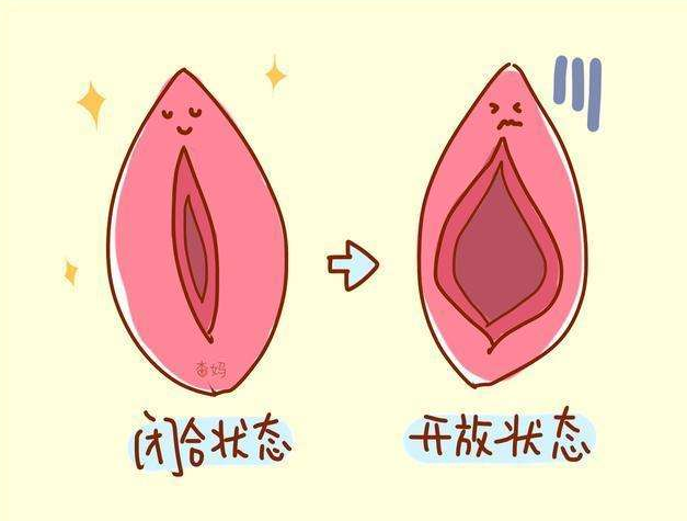 宫口长了个疙瘩怎么办(打胎史是瞒不住的)