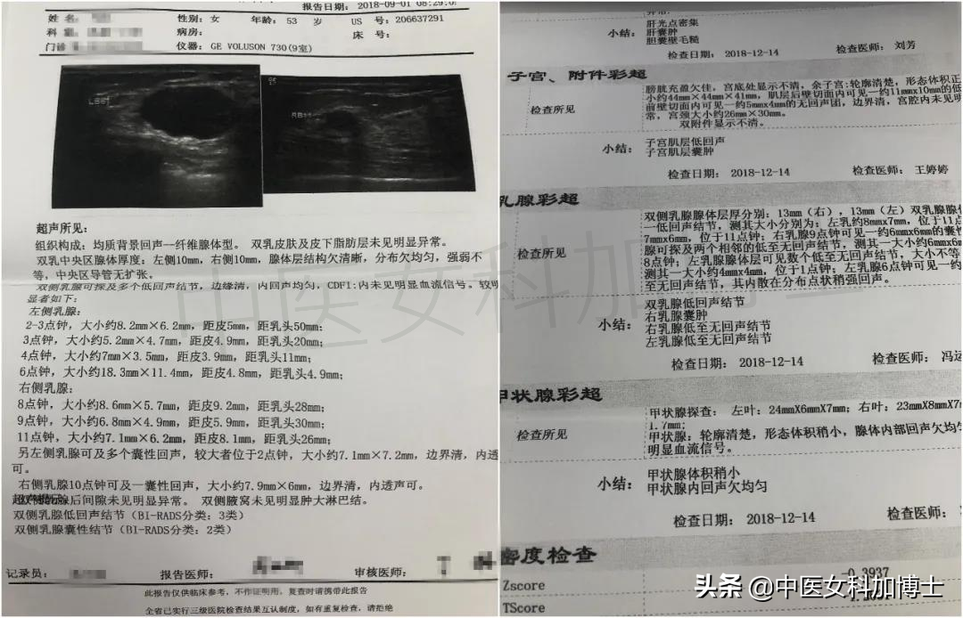 囊肿7cm到2cm，痛经消失，肌瘤变小，好转的她们都有这个共同点