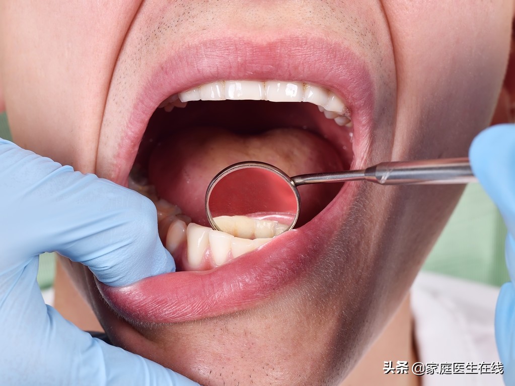 恒牙牙髓炎怎么治疗，4种常见治疗方法，让你少花冤枉钱