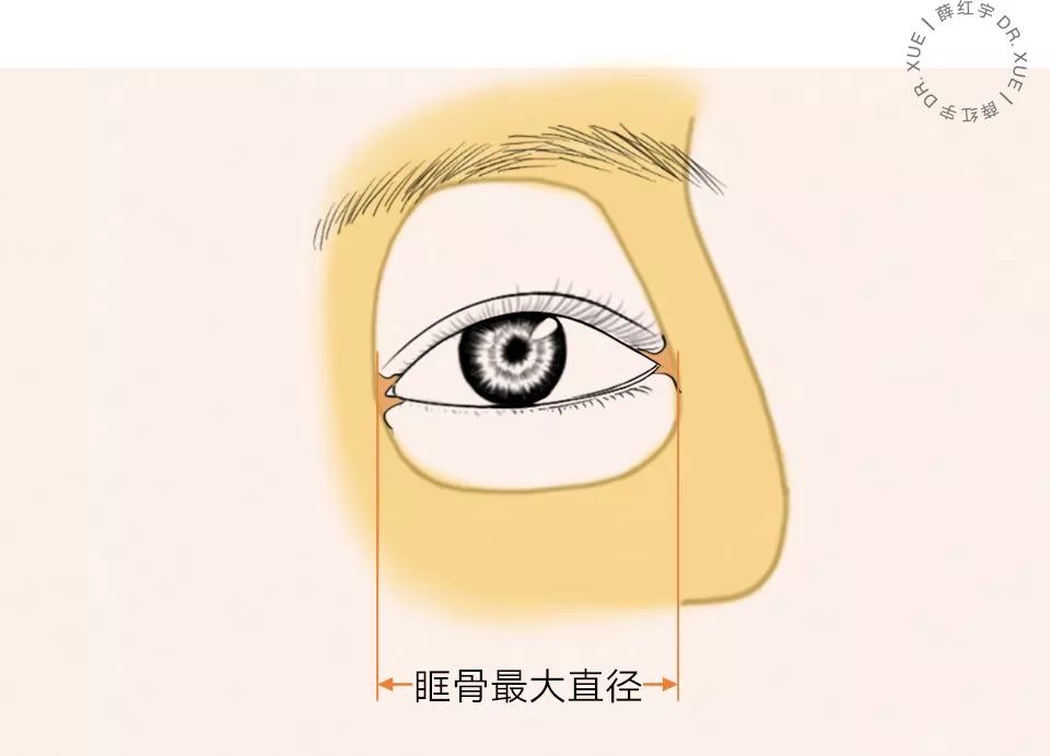 要不要开外眼角？要不要做眼睑下至？