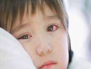 孩子眼睛发红？患有红眼病的饮食与预防，这篇分享给大家